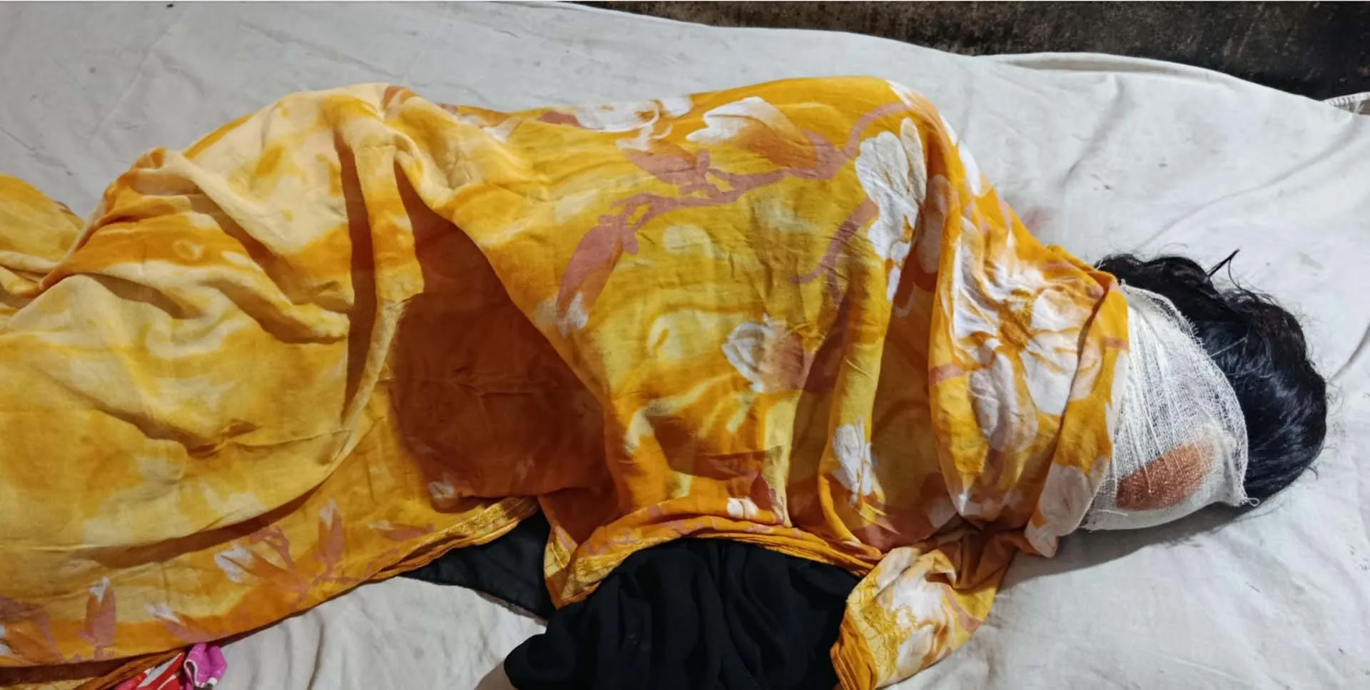 জমি সংক্রান্ত বিরোধে মারামারি,কলেজ ছাত্রী আহত